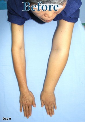 second image